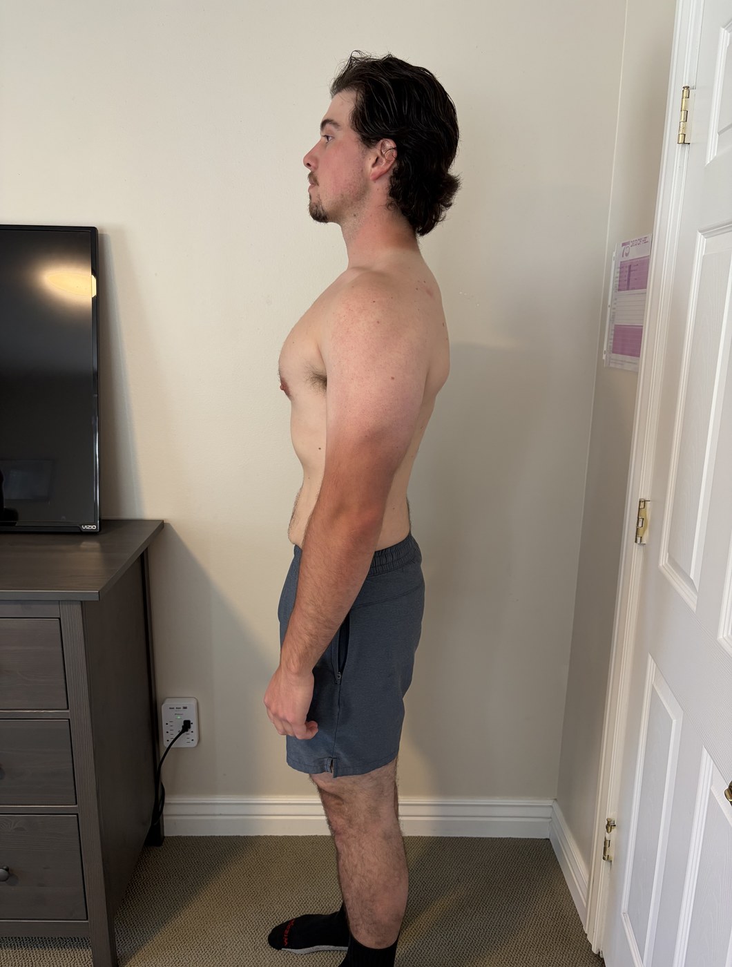 Davis after losing 75 pounds, side profile.