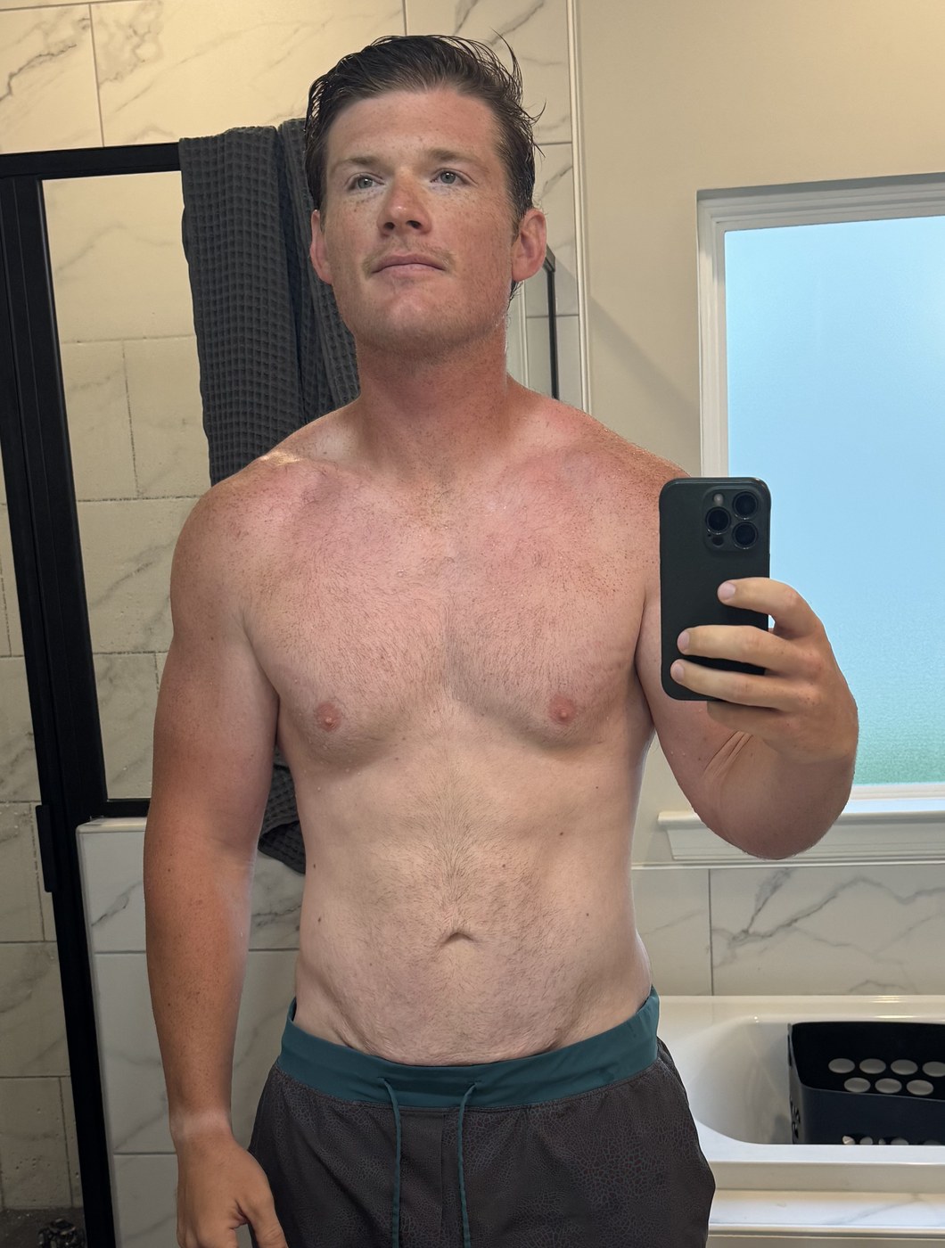 Carter after losing 120 pounds.
